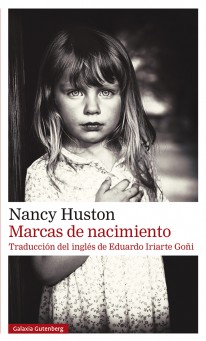 Marcas de nacimiento - 